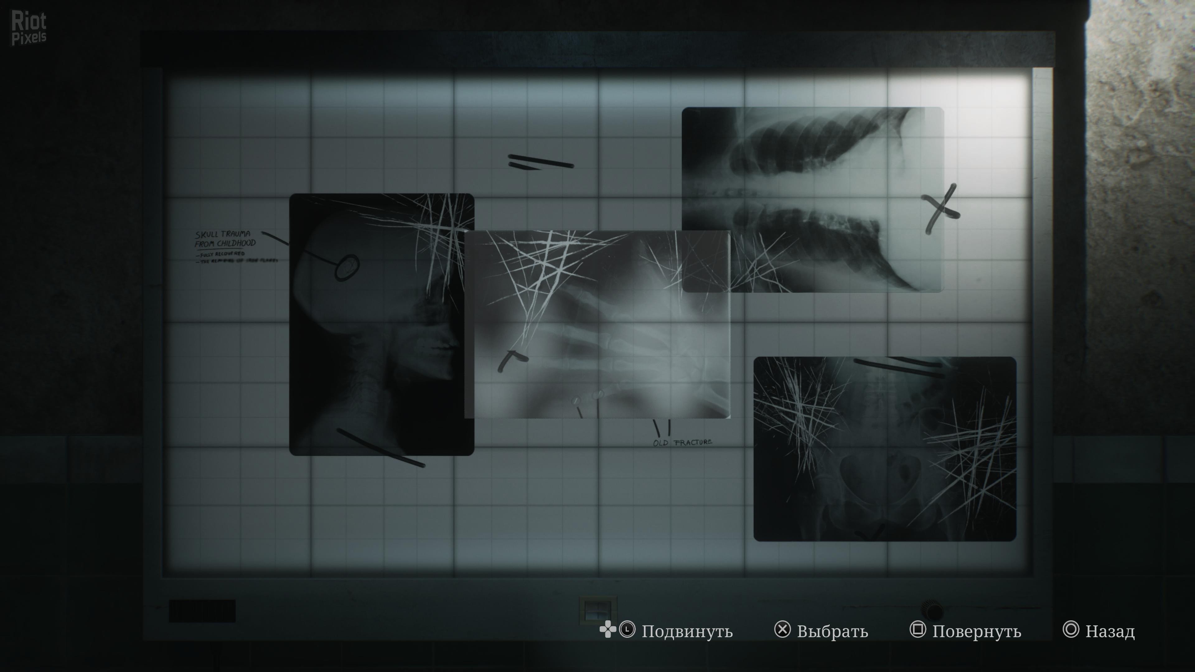 [4]-Silent Hill 2: Digital Deluxe Edition – v1.1.236.114 + 4 DLCs/Bonuses Download-HohohoGames