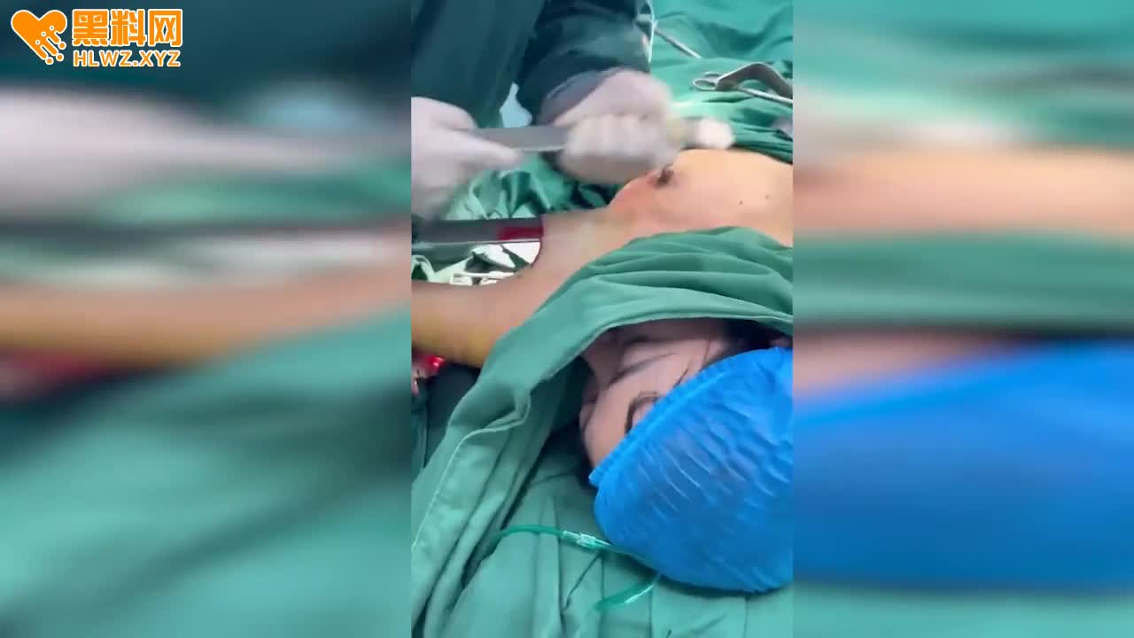 图片[9]-某整形医院 隆胸手术 现场视频泄密 ！这也太恐怖了 小仙女看到要被吓死-赤赤哗热瓜黑料中心