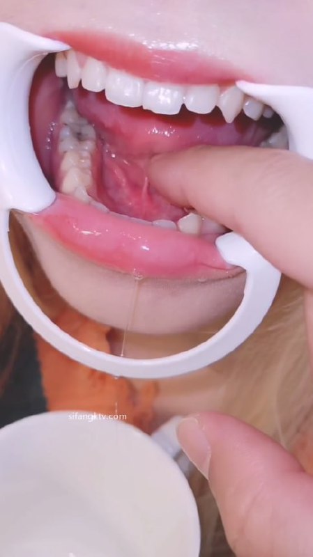 图片[8]-高颜值美少女口腔检查系列 粉嫩口腔不知道喉咙深不见底 深喉一下不知道有多爽-赤赤哗热瓜黑料中心