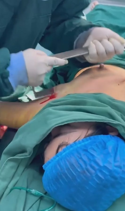 某整形医院 隆胸手术 现场视频泄密 ！这也太恐怖了 小仙女看到要被吓死-赤赤哗热瓜黑料中心